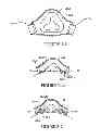 Fig. 11 - Textile mask systems