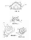 Fig. 12 - Textile mask systems