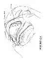 Fig. 13 - Textile mask systems