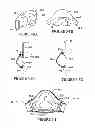 Fig. 15 - Textile mask systems