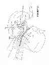 Fig. 17 - Textile mask systems