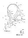 Fig. 34 - Textile mask systems
