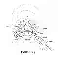 Fig. 41 - Textile mask systems