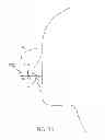 Fig. 08 - Ergonomic and adjustable respiratory mask assembly with cushion