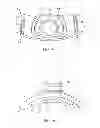 Fig. 09 - Ergonomic and adjustable respiratory mask assembly with cushion