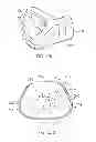 Fig. 35 - Ergonomic and adjustable respiratory mask assembly with cushion