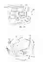 Fig. 52 - Ergonomic and adjustable respiratory mask assembly with cushion