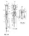 Fig. 08 - Pessaries for prolapse alleviation