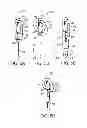 Fig. 09 - Pessaries for prolapse alleviation