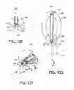 Fig. 22 - Pessaries for prolapse alleviation