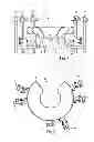 Fig. 02 - Pediatric headrest for skull stabilization and method for use of same