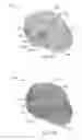 Fig. 15 - MAKEUP APPLICATION ASSIST DEVICE
