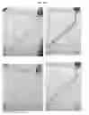 Fig. 07 - AEROSOL DELIVERY TO A MICROFLUIDIC DEVICE
