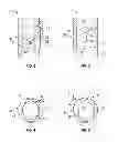 Fig. 03 - CONTINUOUS CIRCULATION VALVE
