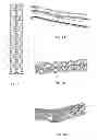 Fig. 02 - Exotensioned structural members with energy-absorbing effects