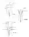 Fig. 09 - Erosion Resistant Wellbore Screen and Associated Methods of Manufacture