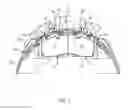 Fig. 04 - Brake caliper assembly having a pad shield