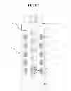 Fig. 04 - Portable pathogen deactivation method and apparatus