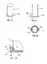 Fig. 18 - Container Closure With Segmented Fusion Ring