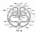 Fig. 22 - Medicament dispenser