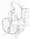 Fig. 01 - Firearm Holster For Secure Storage And Easy Access In A Vehicle