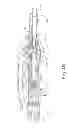 Fig. 07 - SURGICAL STAPLER WITH VARYING STAPLE WIDTHS ALONG DIFFERENT CIRCUMFERENCES