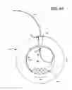 Fig. 04 - Coil assembly having permeable hub