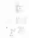 Fig. 04 - Detachable Viewing Apparatuses and Methods of Making and Using the Same