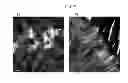 Fig. 13 - Positive electrode active material precursor for lithium secondary battery, positive electrode active material manufactured by using thereof, and lithium secondary battery including same