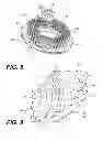 Fig. 08 - Systems for molding non-pneumatic tires
