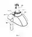 Fig. 35 - Dual steerable vehicle