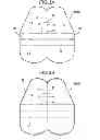 Fig. 04 - Vehicle side airbag device