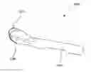 Fig. 01 - CONTACT-LENS PUTTING SUPPORT TOOL