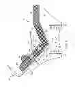 Fig. 08 - Therapeutic Chair