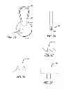Fig. 05 - Device and its use for deterring wearing and returning of merchandise