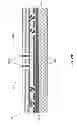 Fig. 41 - Ceramic antenna module and methods of manufacture thereof