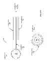 Fig. 14 - Electronic stylus with low skew tip for capacitive touch screens