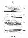 Fig. 10 - System and method for analyzing and imaging three-dimensional volume data sets using a three-dimensional sampling probe