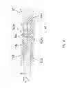 Fig. 04 - Eyeglass frames having removable lens