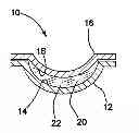 Fig. 01 - Contact lenses, apparatus and methods