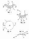 Fig. 02 - Contact lenses, apparatus and methods