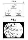 Fig. 03 - OPHTHALMIC IMAGING APPARATUS, CONTROL METHOD OF OPHTHALMIC IMAGING APPARATUS AND STORAGE MEDIUM