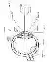 Fig. 03 - Self-aligning unobtrusive active eye interrogation