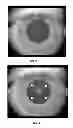 Fig. 04 - Methods for objectively determining the visual axis of the eye and measuring its refraction
