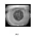 Fig. 07 - Methods for objectively determining the visual axis of the eye and measuring its refraction