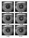 Fig. 08 - Methods for objectively determining the visual axis of the eye and measuring its refraction