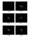 Fig. 09 - Methods for objectively determining the visual axis of the eye and measuring its refraction