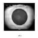 Fig. 10 - Methods for objectively determining the visual axis of the eye and measuring its refraction