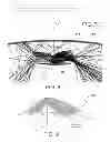 Fig. 04 - Lens-reflector combination for batwing light distribution