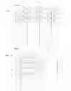 Fig. 04 - Speed typing apparatus